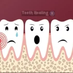 Dos and Donts After Wisdom Tooth Extraction_ A Comprehensive Guide