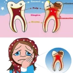 teeth healing