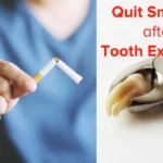 when can you smoke after tooth extraction