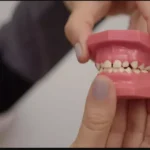 Problemas na arcada dentária: como identificar e tratar