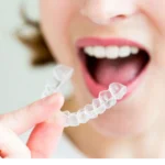 Say Goodbye to Braces and Hello to Invisalign: A Guide to Getting Started