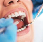 The Importance of Regular Dental Check-Ups: A Comprehensive Guide